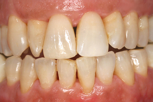 parodontie dentiste palaiseau